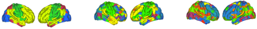 IRM cerveau S. Achard